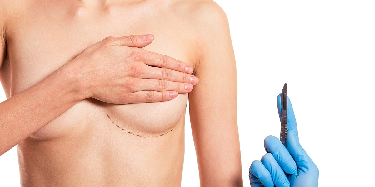 Surgical preparation for breast procedure with scalpel.