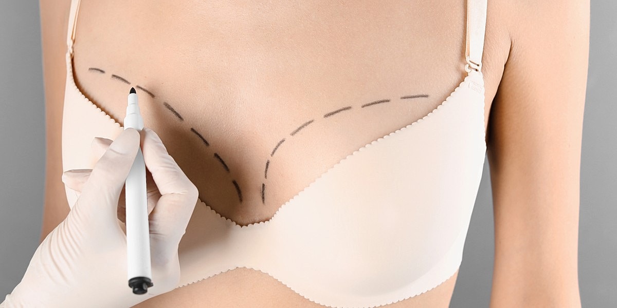 Medical professional marking for procedure on chest.