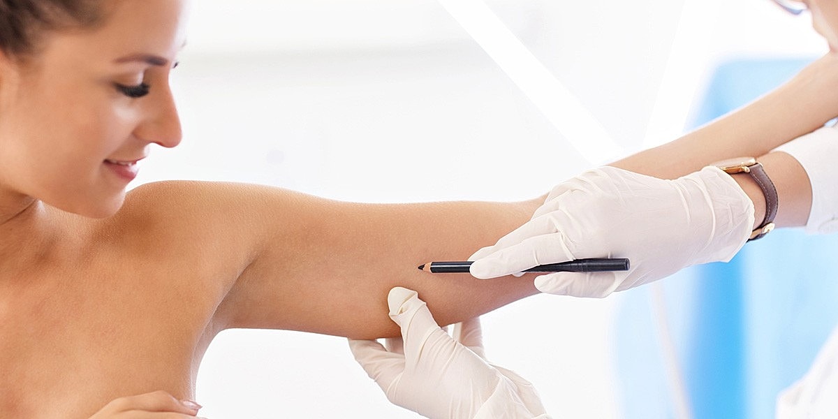 Medical consultation for skin treatment procedure.