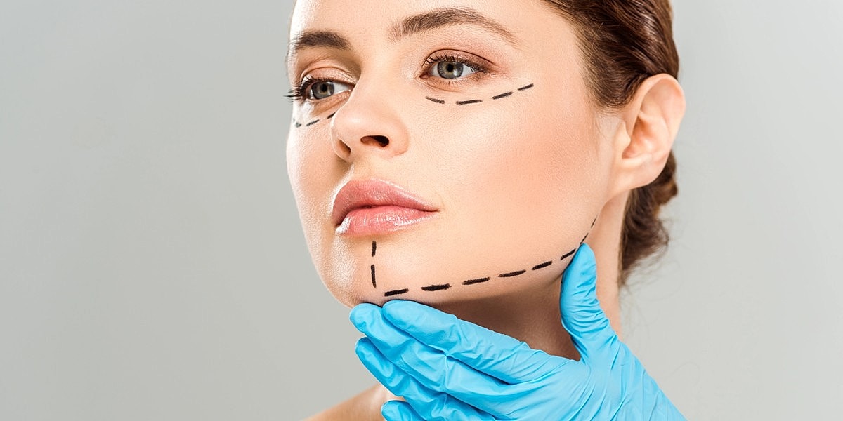 Woman with facial markings for surgery consultation.