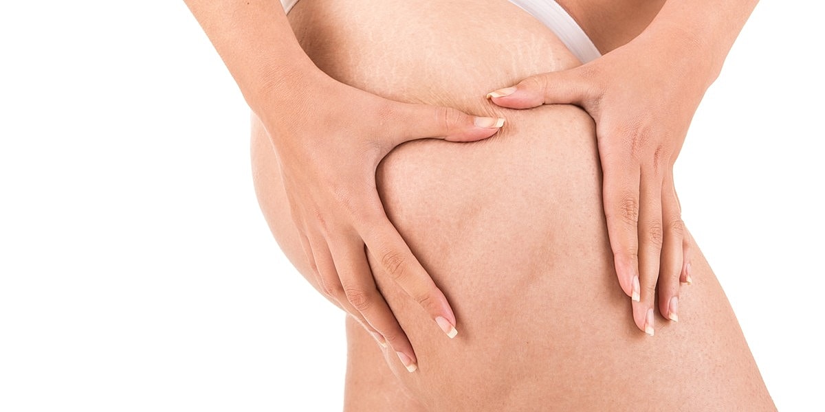 Woman holding her thigh with both hands.
