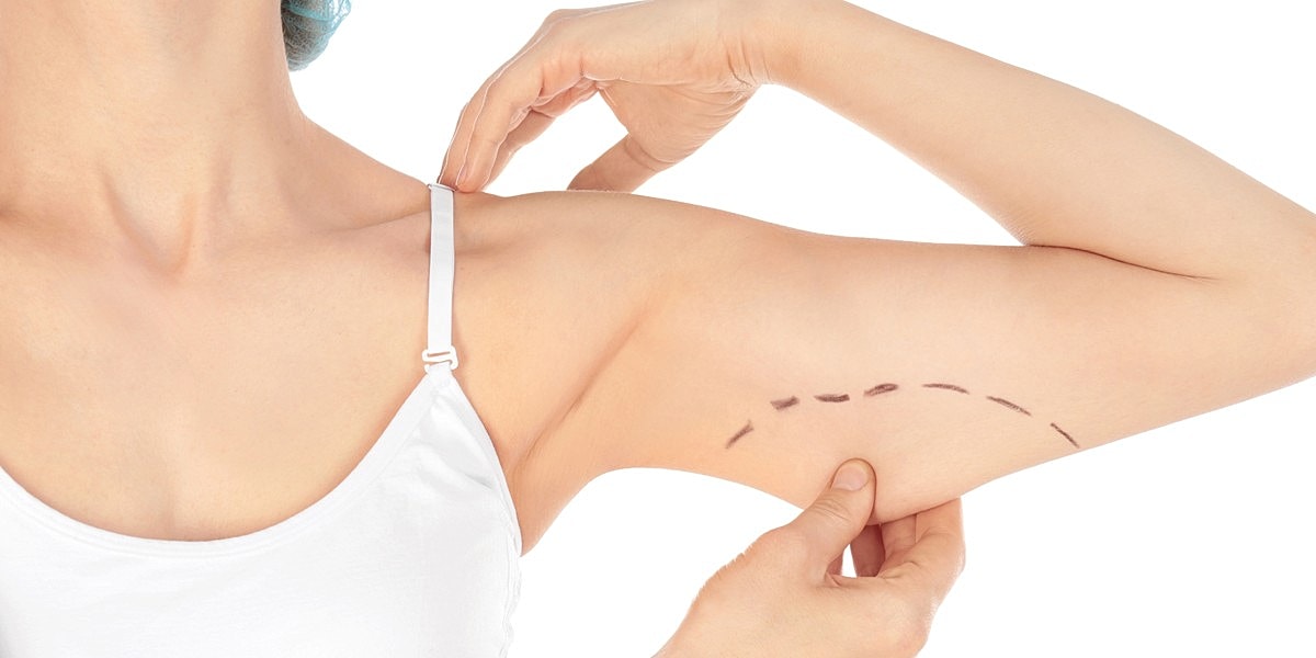 Woman preparing for a cosmetic procedure on arm.
